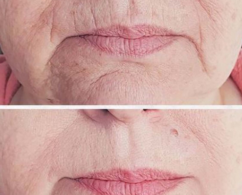 eliminar codigo de barras madrid